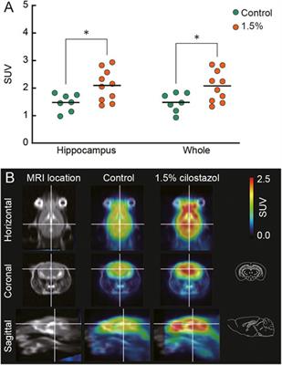 Reversal of spatial memory impairment by phosphodiesterase 3 inhibitor cilostazol is associated with reduced neuroinflammation and increased cerebral glucose uptake in aged male mice